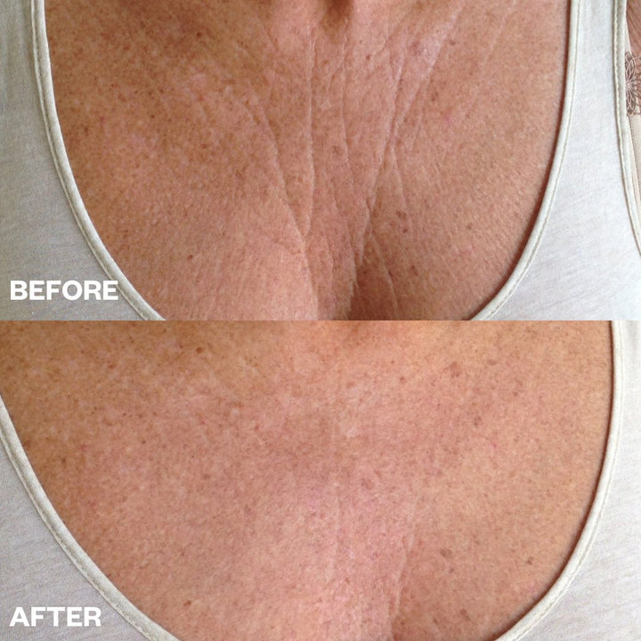 Beauty + WellnessChest Wrinkle Patch